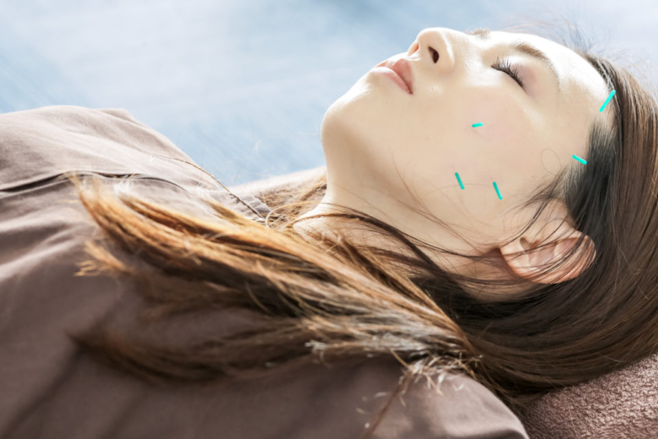 ✨ 美容鍼×パルスで肌の奥からリフトアップ ✨ | えがお鍼灸整骨院 栗東院